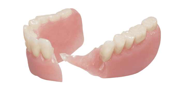 Denture Repair (Fracture)
